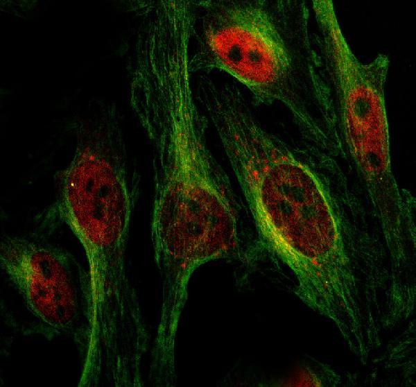 a05749 2 chd1l primary antibodies if testing 1