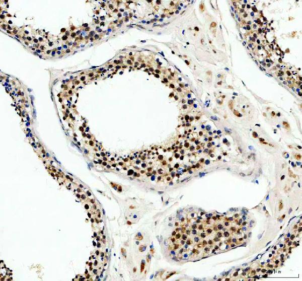 IHC analysis of CHD1L using anti-CHD1L antibody (A05749-2)