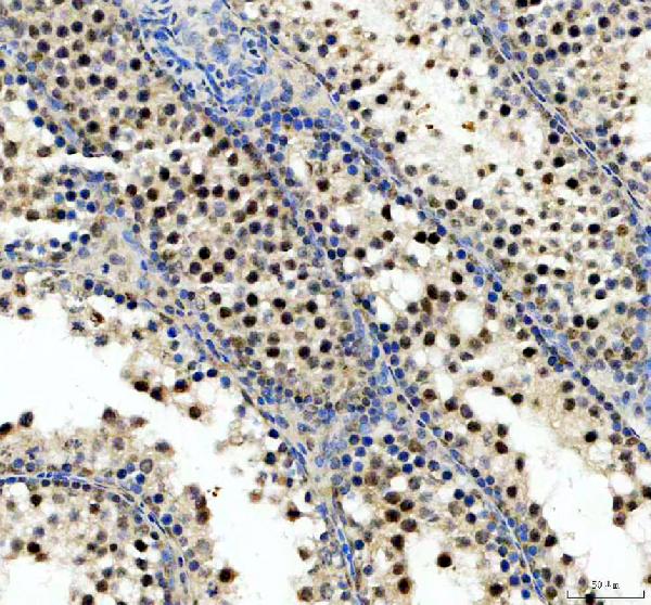 IHC analysis of CHD1L using anti-CHD1L antibody (A05749-2)