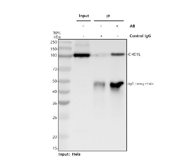 a05749 2 chd1l primary antibodies ip testing 1