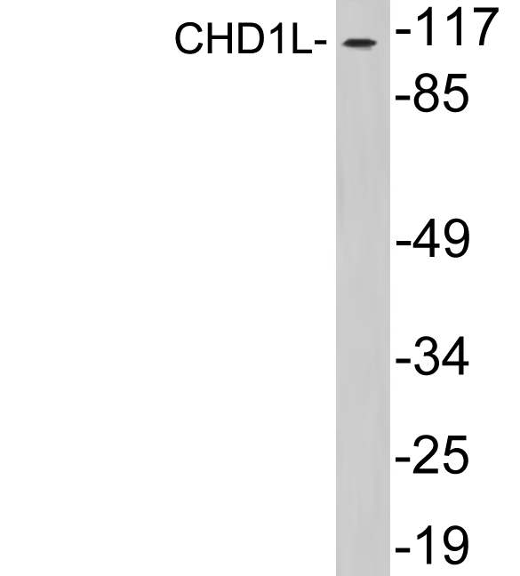 Western blot analysis of lysates from HepG2 cells, using CHD1L antibody