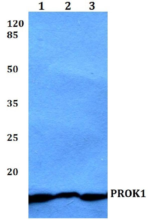 a05751 prok1 primary antiboties wb testing 1
