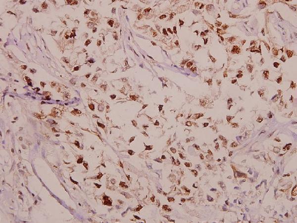 a05752t38 ppp1r14a primary antiboties ihc testing 2