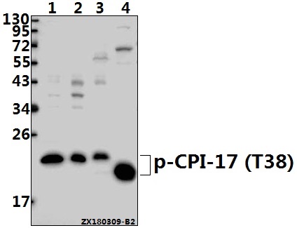 a05752t38 ppp1r14a primary antiboties wb testing 1