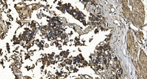 a05753 1 rgs6 primary antibodies ihc testing 2