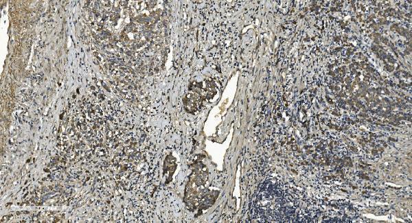 a05753 1 rgs6 primary antibodies ihc testing 3