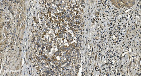a05753 1 rgs6 primary antibodies ihc testing 4