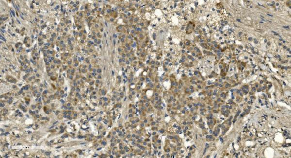 a05753 1 rgs6 primary antibodies ihc testing 6