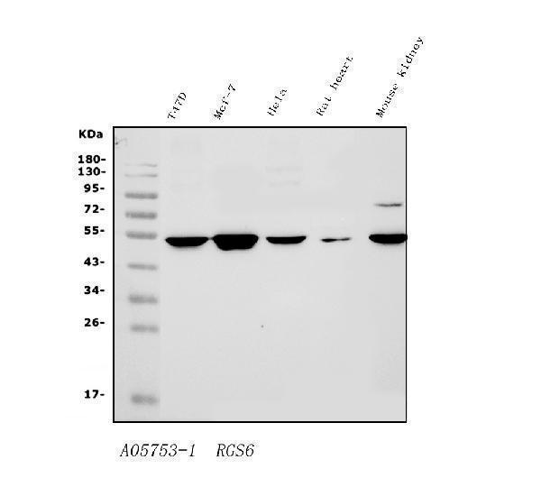 a05753 1 rgs6 primary antibodies wb testing 1