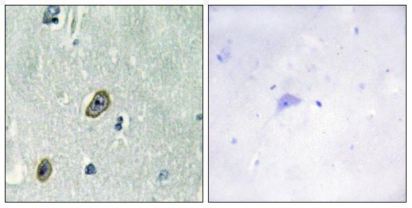 Immunohistochemistry analysis of paraffin-embedded human brain tissue, using KCIP1 Antibody