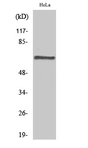 Western Blot (WB) analysis of specific cells using PP2A-Abeta Polyclonal antibody