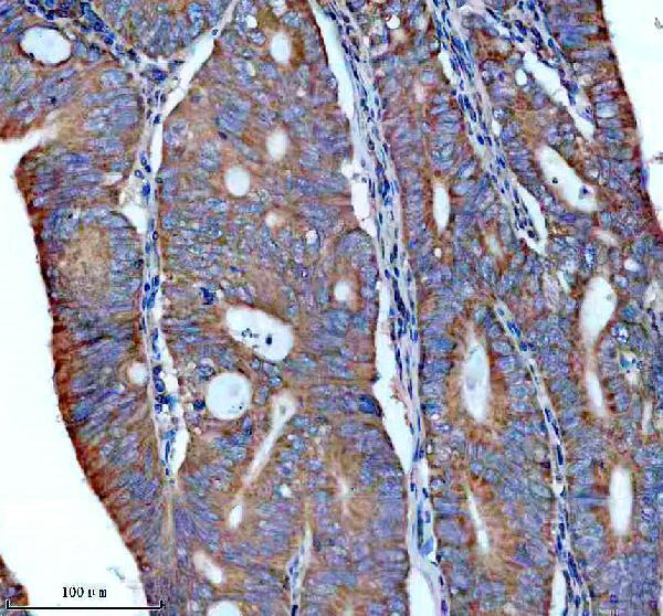 IHC analysis of PPP2R1B using anti-PPP2R1B antibody (A05756-4)
