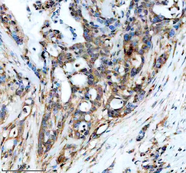 IHC analysis of PPP2R1B using anti-PPP2R1B antibody (A05756-4)