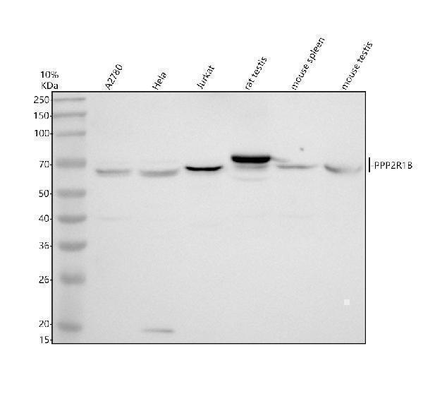 Western blot analysis of PPP2R1B using anti-PPP2R1B antibody (A05756-4)