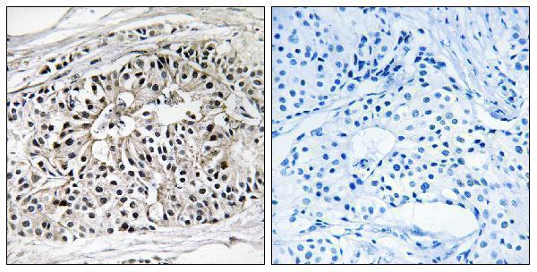 a05757 1 ehhadh primary antibodies ihc testing 1
