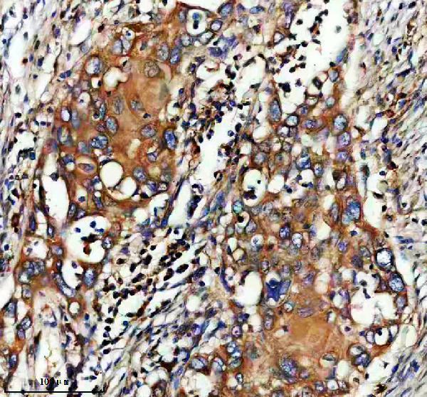 IHC analysis of FAM83H using anti-FAM83H antibody (A05758-1)