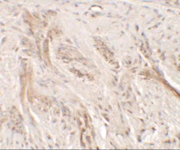 a05759 il36g primary antibodies ihc testing 2