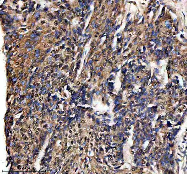 IHC analysis of NKX6-1 using anti-NKX6-1 antibody (A05760-1)