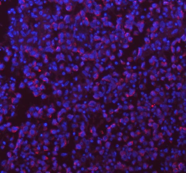 a05762 1 sass6 primary antibodies if testing 14