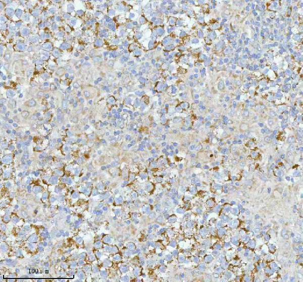 a05762 1 sass6 primary antibodies ihc testing 11