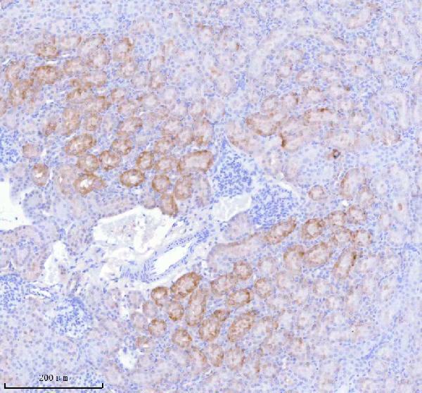 a05762 1 sass6 primary antibodies ihc testing 12