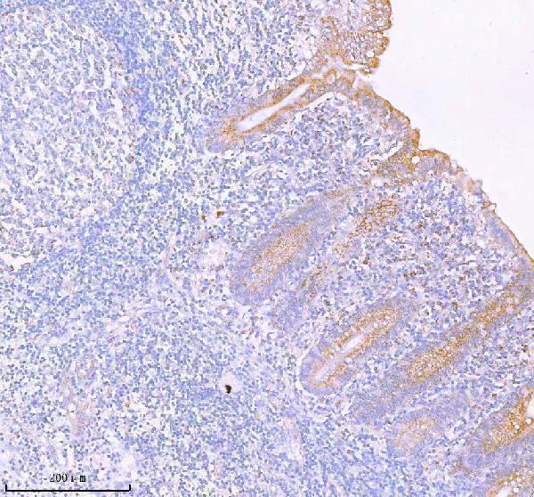  IHC analysis of SASS6 using anti-SASS6 antibody (A05762-1)