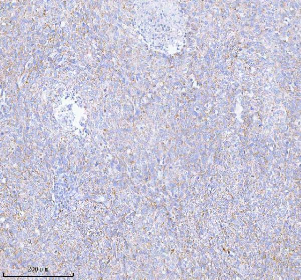a05762 1 sass6 primary antibodies ihc testing 6