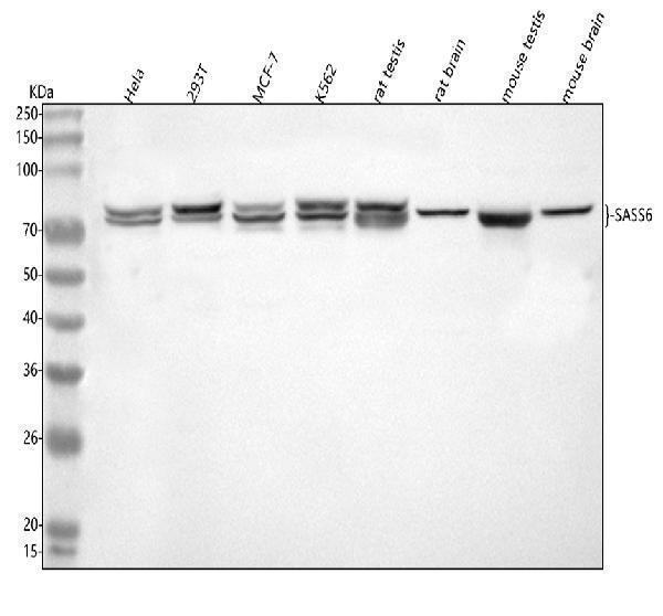  Western blot analysis of SASS6 using anti-SASS6 antibody (A05762-1)