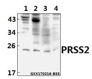 a05763 prss2 primary antiboties wb testing 1