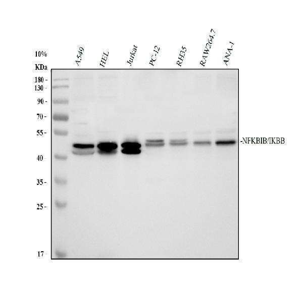 Western blot analysis of IkB Beta/NFKBIB using anti-IkB Beta/NFKBIB antibody (A05766-1)