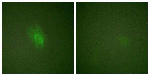 a05766s23 nfkbib primary antibodies if testing 5