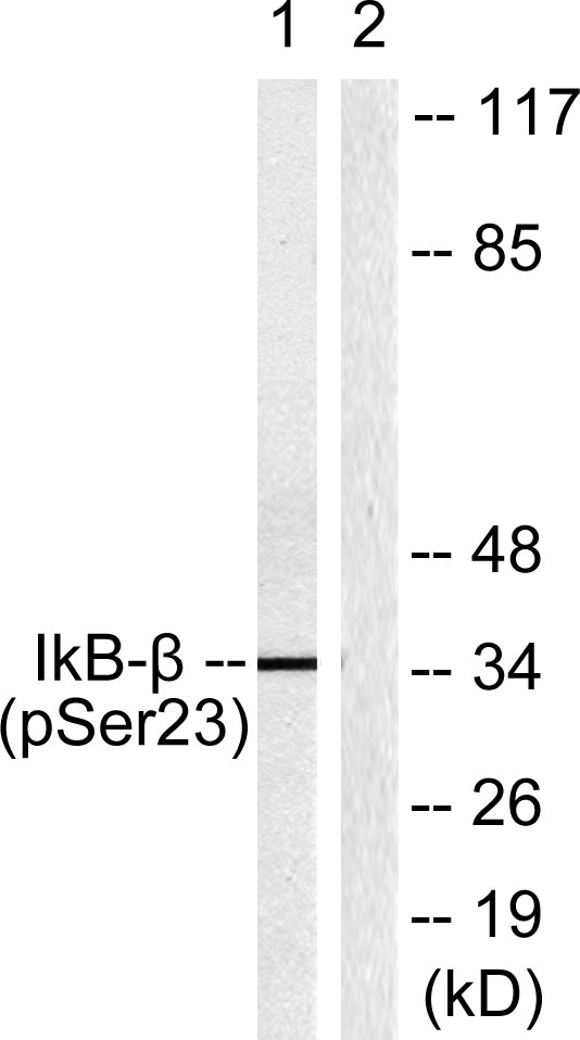 Western blot analysis of lysates from HeLa cells treated with TNF-a 20ng/ml 5