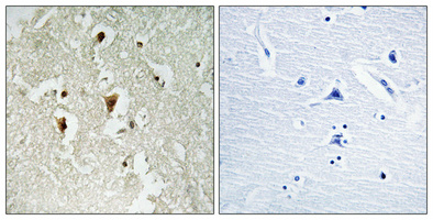 Immunohistochemical analysis of paraffin-embedded Human brain