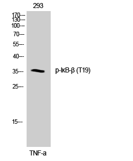Western Blot analysis of 293 cells using Phospho-IκB-β (T19) Polyclonal Antibody