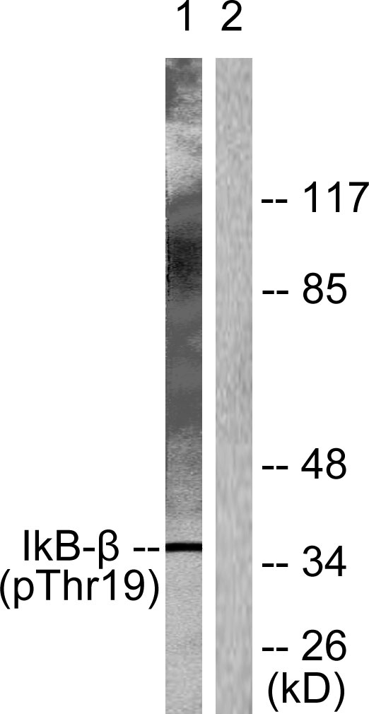 Western blot analysis of lysates from 293 cells treated with TNF-a 20ng/ml 30