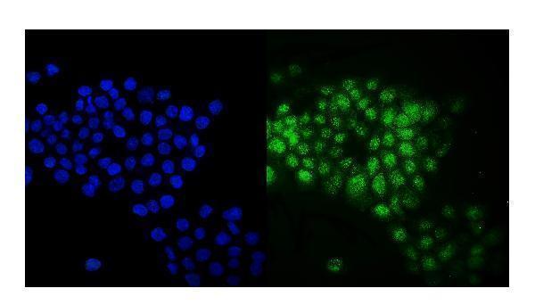  IF analysis of Rab9/RAB9A using anti-Rab9/RAB9A antibody (A05768)