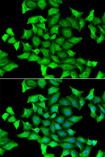 Immunofluorescence analysis of U2OS cells using SEPSECS antibody 