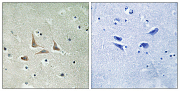 Immunohistochemical analysis of paraffin-embedded Human brain