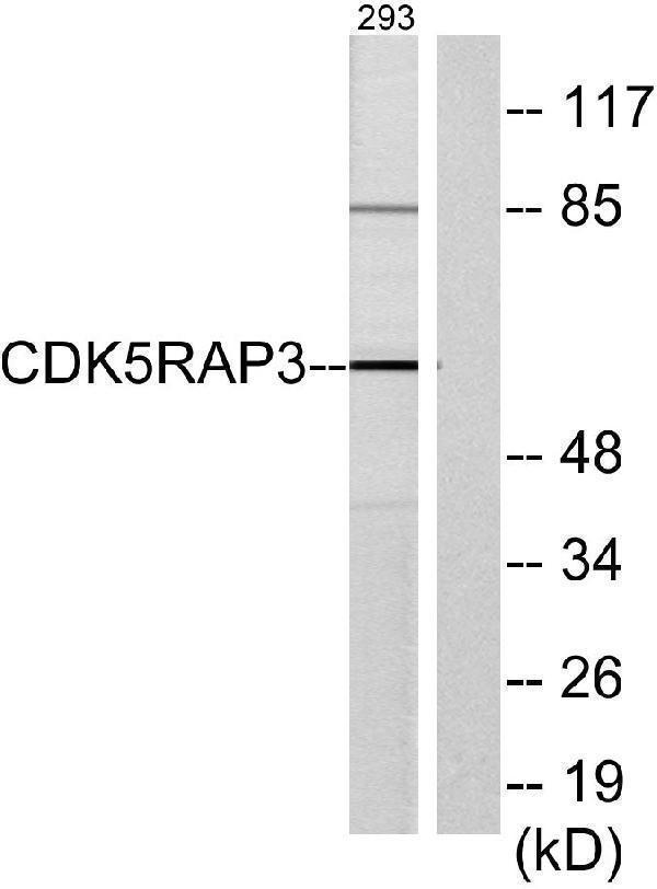 Western blot analysis of lysates from 293 cells, using CDK5RAP3 Antibody