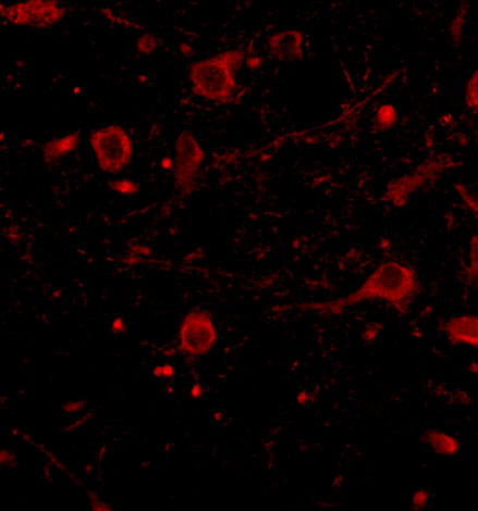 a05771 cadps primary antibodies if testing 3