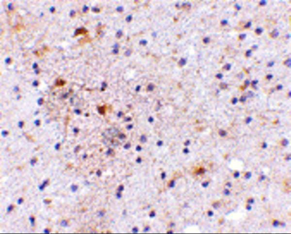 a05771 cadps primary antibodies ihc testing 2