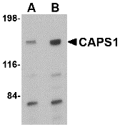 a05771 cadps primary antibodies wb testing 1