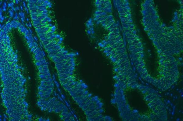 a05772 1 txndc5 primary antibodies if testing 11