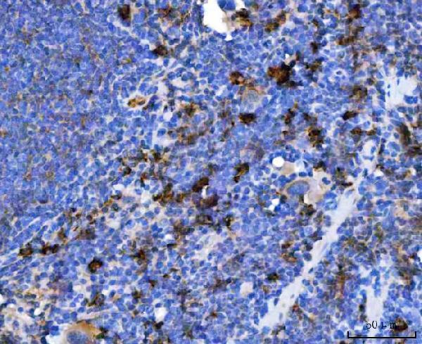 a05772 1 txndc5 primary antibodies ihc testing 10