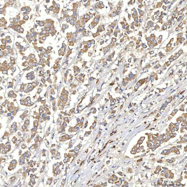  IHC analysis of TXNDC5 using anti-TXNDC5 antibody (A05772-1)