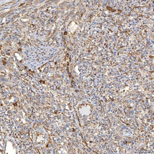  IHC analysis of TXNDC5 using anti-TXNDC5 antibody (A05772-1)
