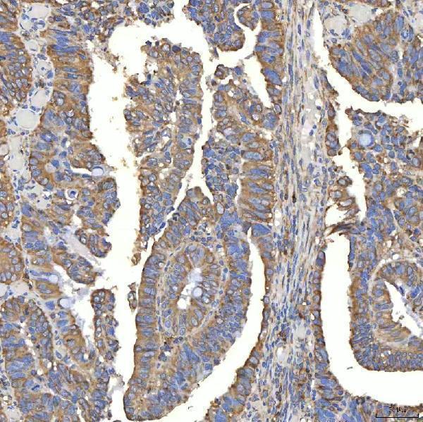 a05772 1 txndc5 primary antibodies ihc testing 5