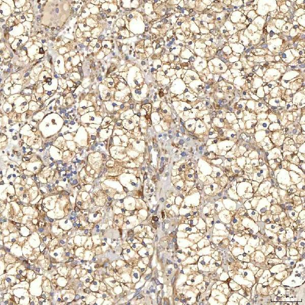 a05772 1 txndc5 primary antibodies ihc testing 6
