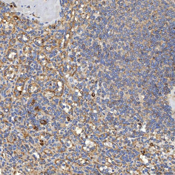 a05772 1 txndc5 primary antibodies ihc testing 7