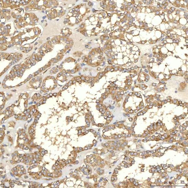 a05772 1 txndc5 primary antibodies ihc testing 8